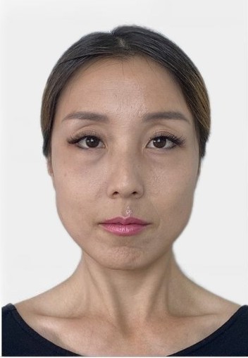 Sample Of Evisa Photo